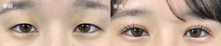 ベスト症例写真