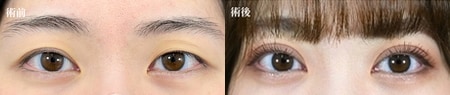 ベスト症例写真