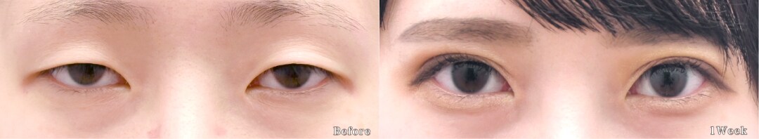 ベスト症例写真