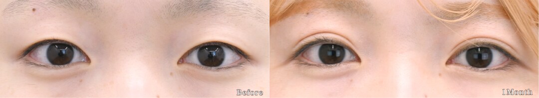 ベスト症例写真