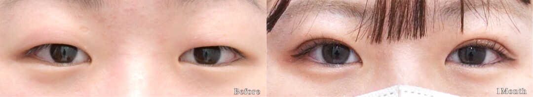 ベスト症例写真