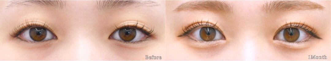 ベスト症例写真