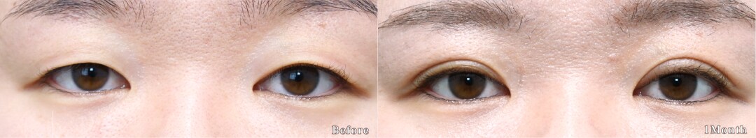 ベスト症例写真