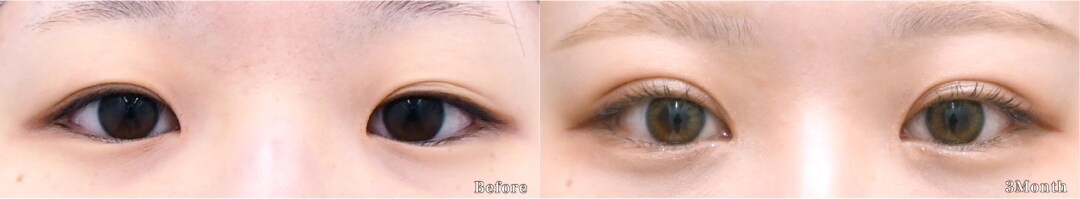 ベスト症例写真