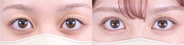 ベスト症例写真