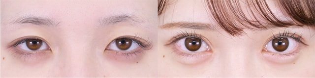 ベスト症例写真