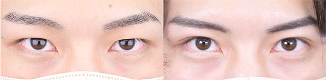 ベスト症例写真