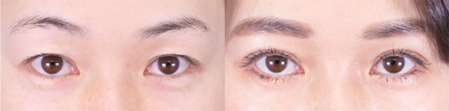 ベスト症例写真