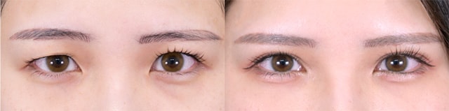 ベスト症例写真