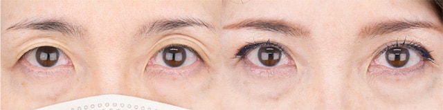 ベスト症例写真