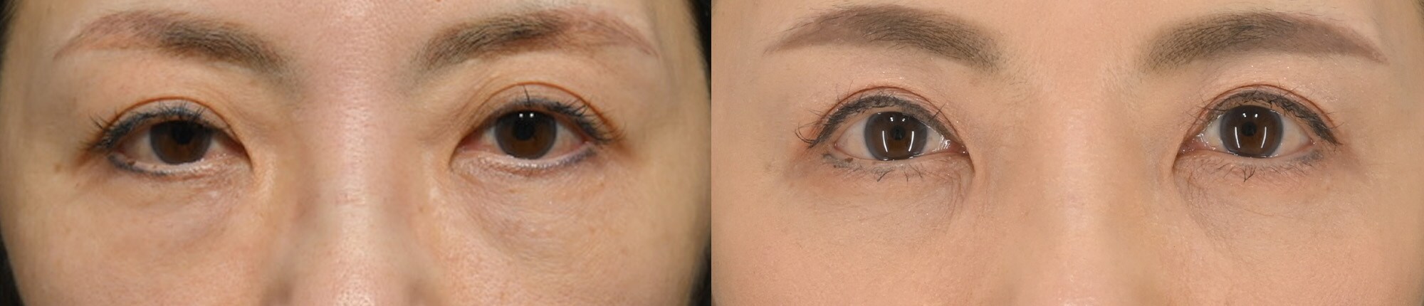 ベスト症例写真