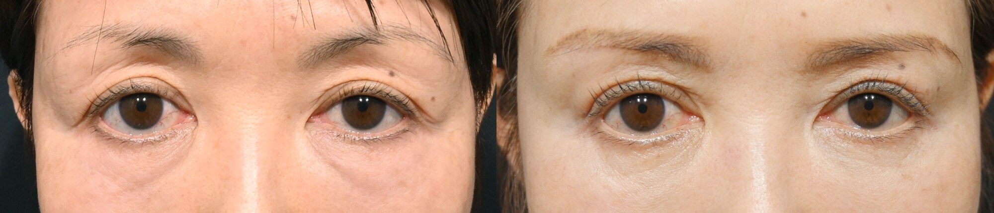 ベスト症例写真