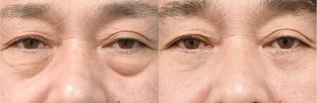 ベスト症例写真