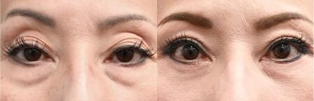 ベスト症例写真