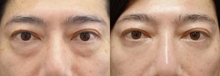 ベスト症例写真