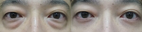 ベスト症例写真