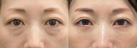 ベスト症例写真