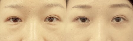 ベスト症例写真