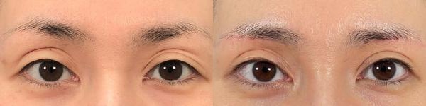 ベスト症例写真