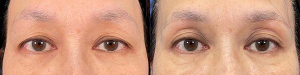 ベスト症例写真