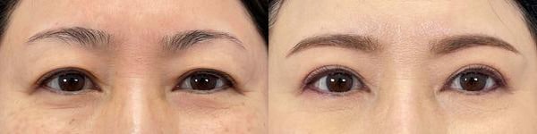 ベスト症例写真