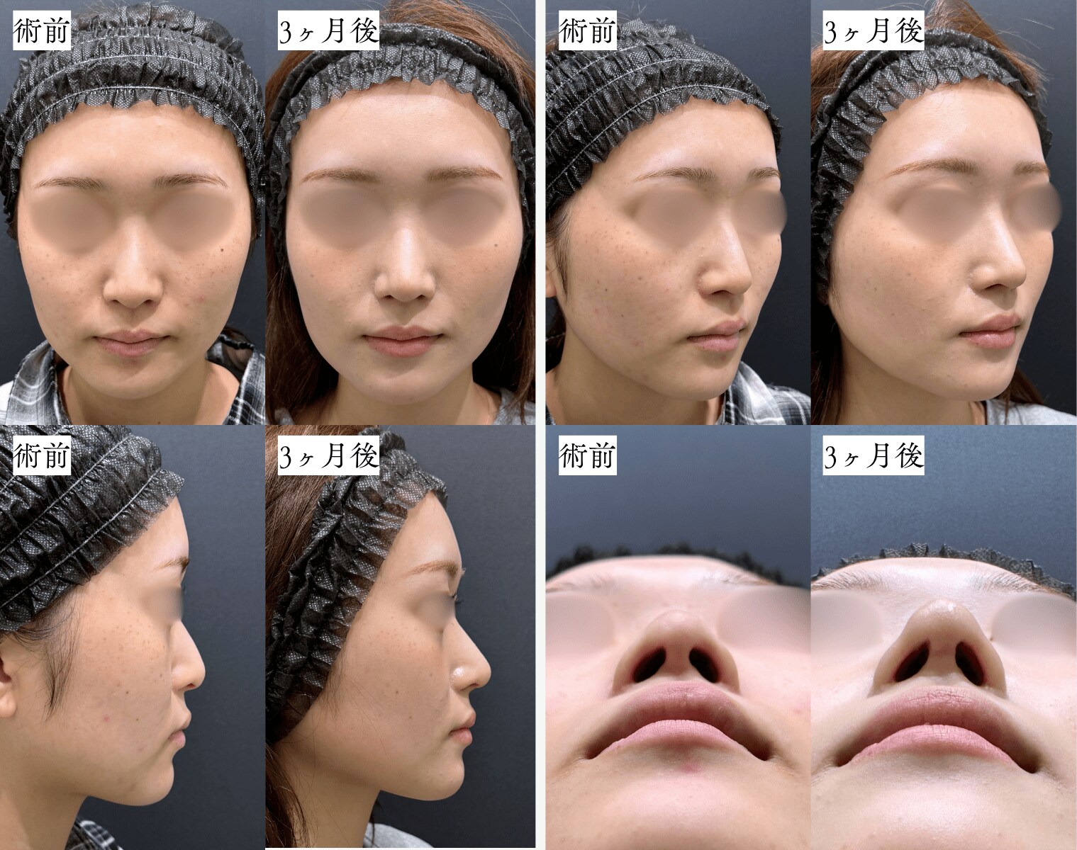 ベスト症例写真