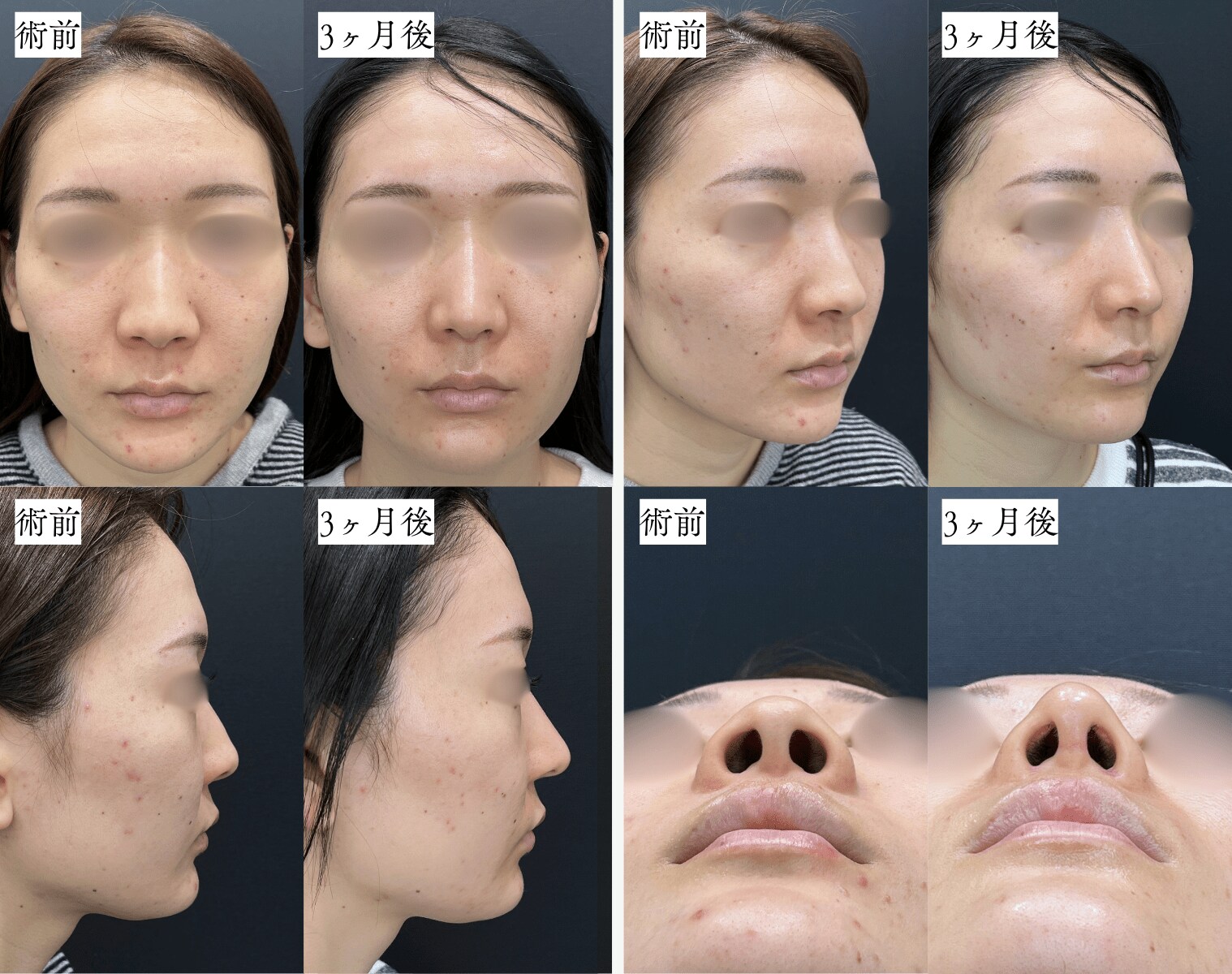 ベスト症例写真