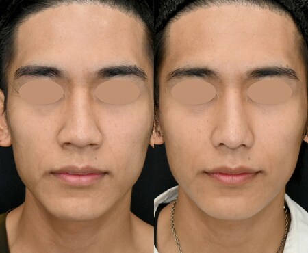 ベスト症例写真