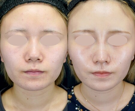 ベスト症例写真