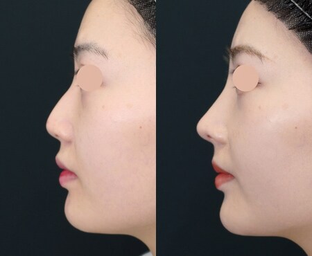 ベスト症例写真