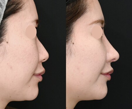 ベスト症例写真