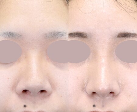 ベスト症例写真