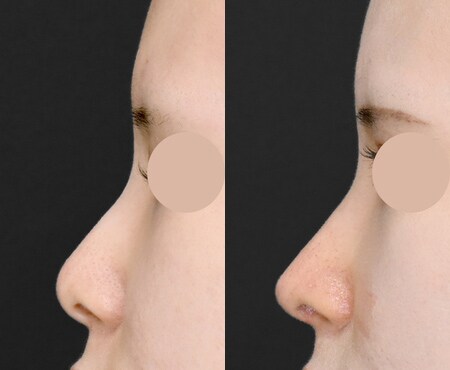 ベスト症例写真