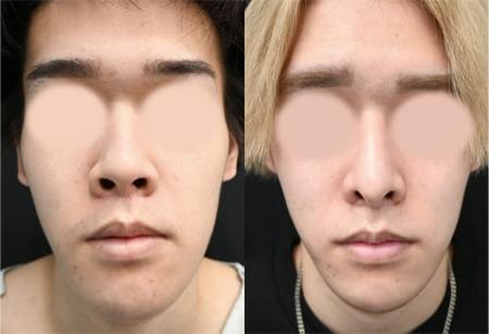 ベスト症例写真