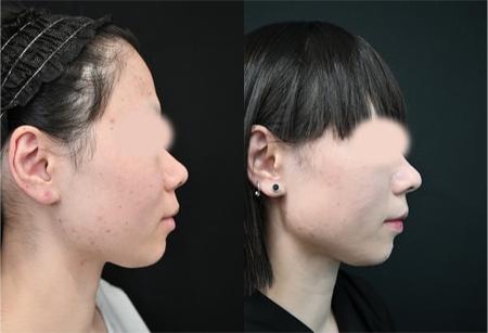 ベスト症例写真