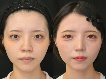 ベスト症例写真