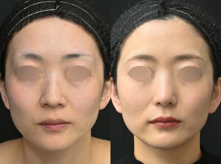 ベスト症例写真