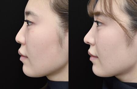 ベスト症例写真