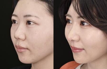 ベスト症例写真