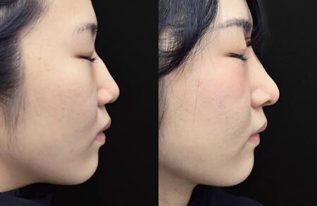 ベスト症例写真