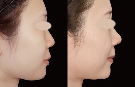 ベスト症例写真