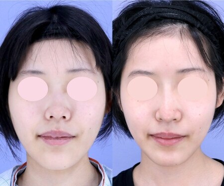 ベスト症例写真