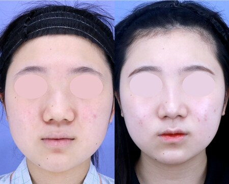 ベスト症例写真