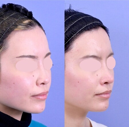 ベスト症例写真