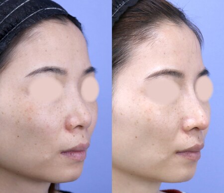 ベスト症例写真