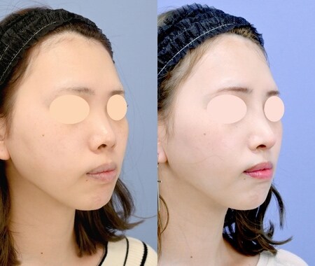 ベスト症例写真