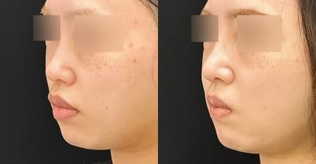 ベスト症例写真