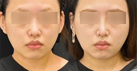 ベスト症例写真