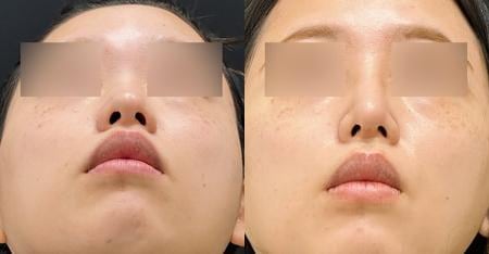 ベスト症例写真