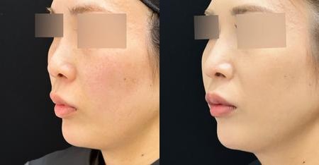 ベスト症例写真